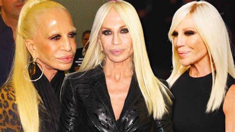 versace donatella marito|donatella versace face what happened.